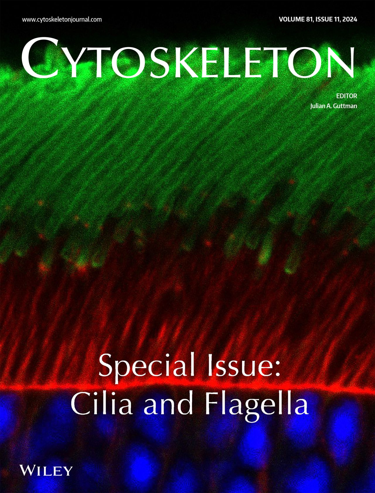 Cytoskeleton structure in photoreceptors