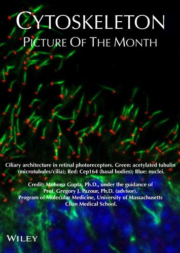 Cytoskeleton dynamics in ciliary transport
